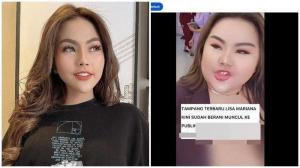 Akui Kasih Rp20 Juta per Bulan ke Lisa Mariana, Ridwan Kamil: Kasian, Selaku Gubernur Punya Empati