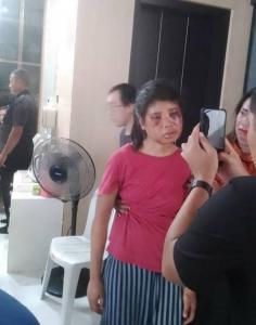  ART Jadi Korban Penyiksaan di Batam, Pemerintah Didesak Segera Sahkan RUU PPRT