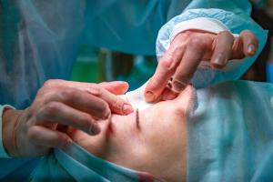 Rhinoplasty Bukan Cuma Estetika, Ini Manfaatnya!