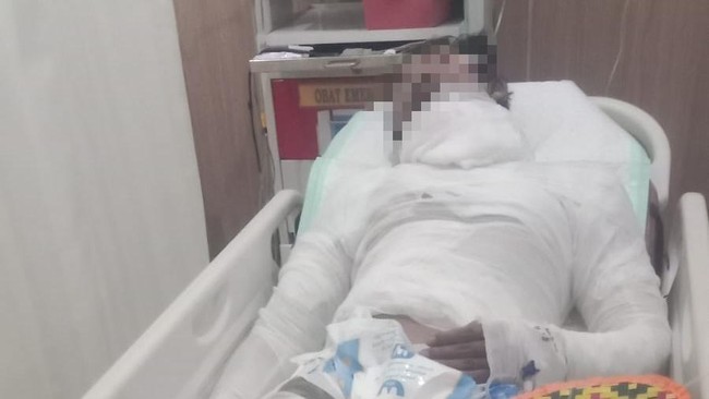 Tragis! Sopir Truk di Bali Dibakar Hidup-hidup oleh Bosnya, Penyebabnya Bikin Geleng Kepala