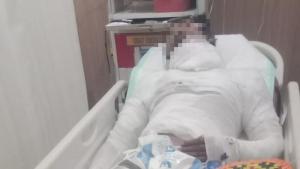 Tragis! Sopir Truk di Bali Dibakar Hidup-hidup oleh Bosnya, Penyebabnya Bikin Geleng Kepala